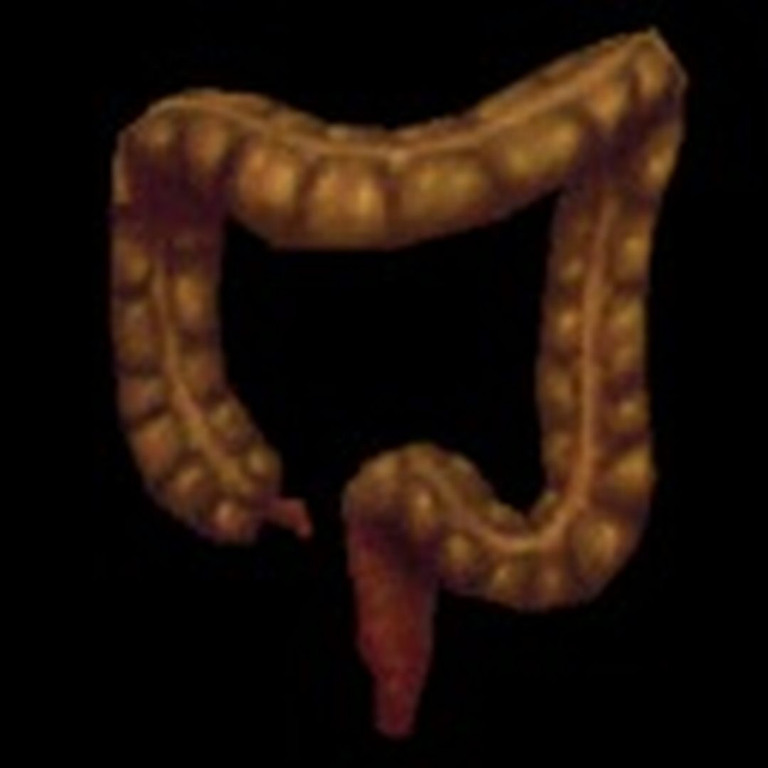 大肠的复仇/Revenge Of The Colon